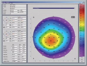 Pentacam - Pachymetry_Map