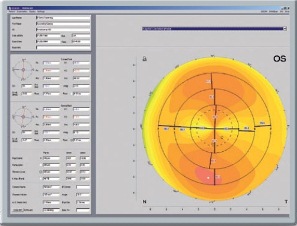 Pentacam - Topography_Map