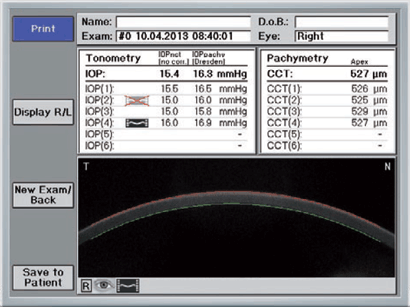 Corvis STL - iop-and-corneal-thickness-measurements